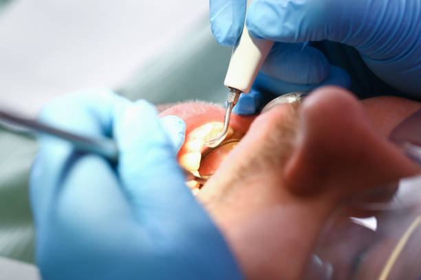 Best Walk-In Emergency Dentist in Parshall, ND