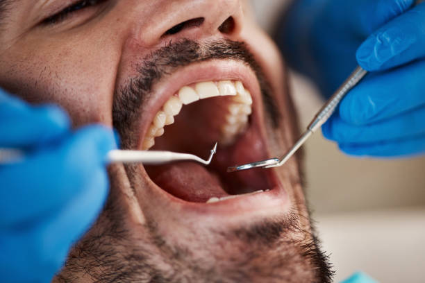 Best Emergency Dental Surgery in Parshall, ND